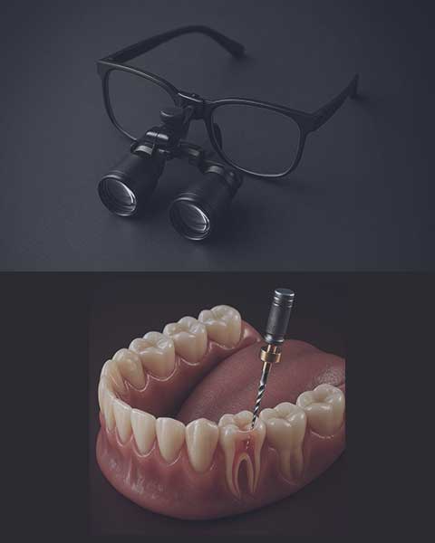 マイクロスコープ・ニッケルチタンファイル